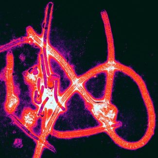 Ebola Virus Particles cc Thomas W. Geisbert