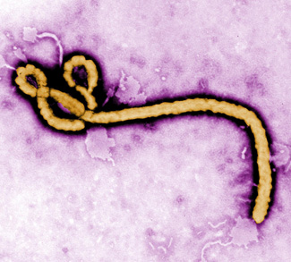 ebolacdc, cc Flickr CDC global, modified, https://creativecommons.org/licenses/by/2.0/