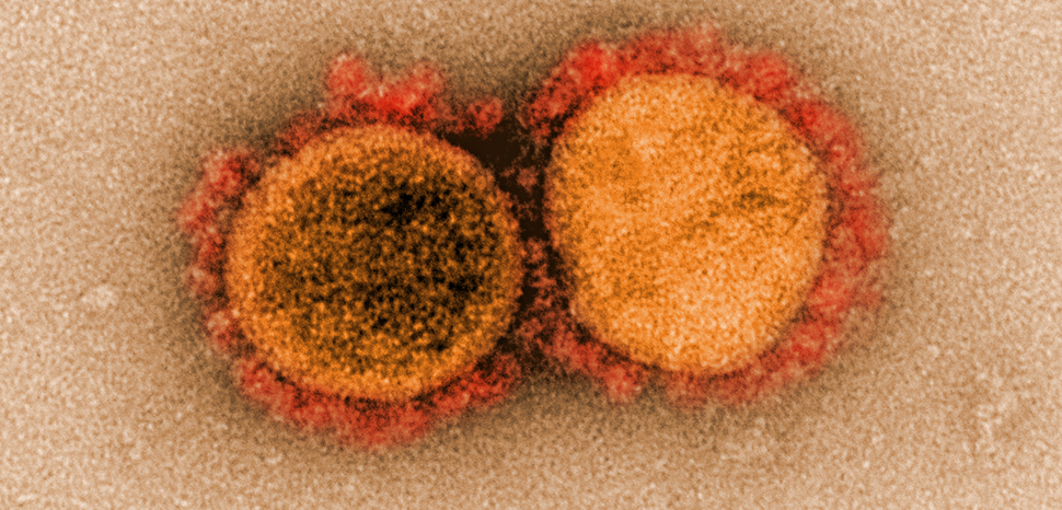 COVID19-virus, cc Flickr NIAID, modified, https://creativecommons.org/licenses/by/2.0/
